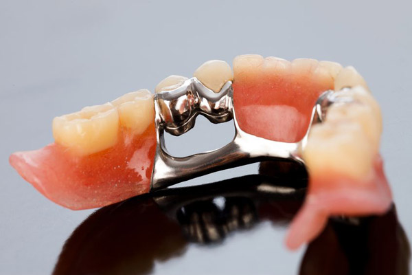 Denture2