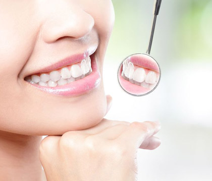tooth-color-filling2